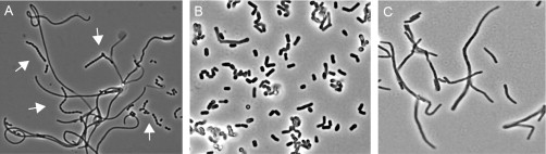 streptomyces-avermitilis-bacterium